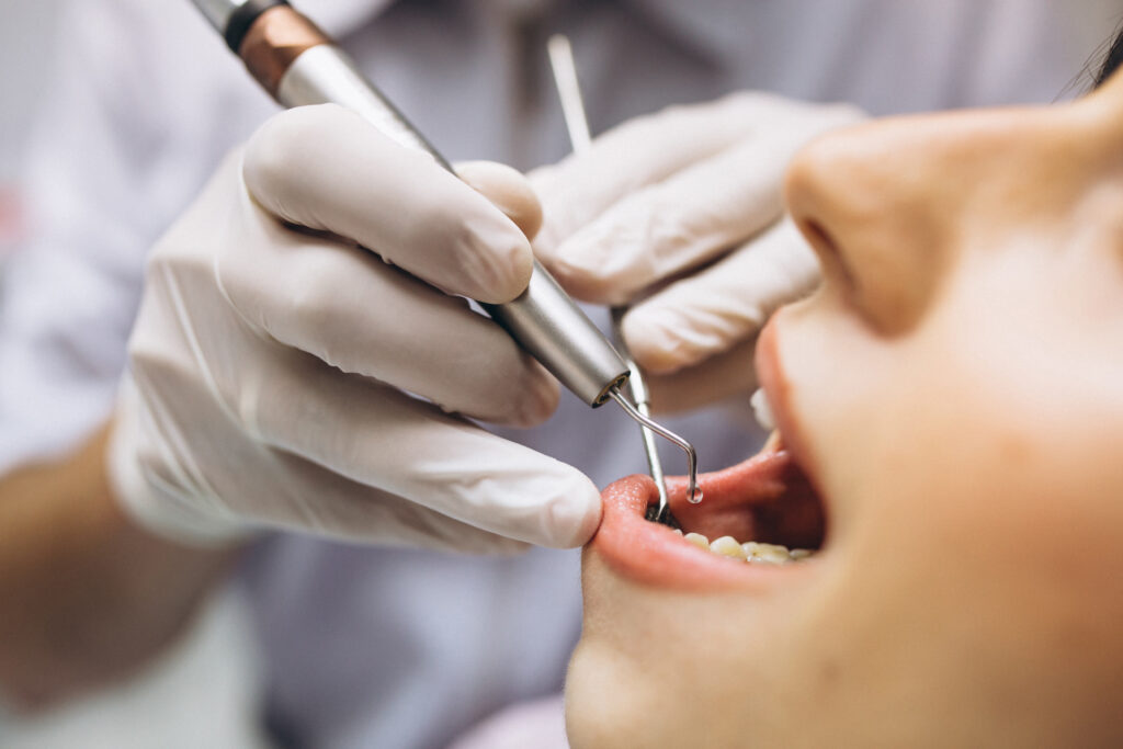 LIMPIEZA DENTAL