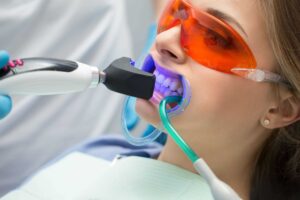 Lee más sobre el artículo ACLARAMIENTO Y DISEÑO DE SONRISA, MITOS Y REALIDADES